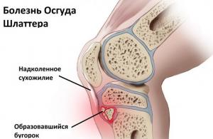 Рентген коленного сустава: показания и противопоказания, норма и патология Выглядит здоровый коленный сустав